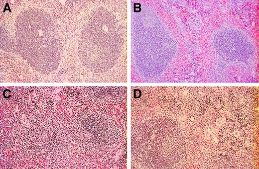 Fig. 8. Histopathological studies of spleens from wild-type, L-selectin–deficient, E/P double-selectin–null, and E/L/P triple-selectin–null mice. / (A) The normal red and white pulp architecture of the spleen was present in control mice (n = 6). (B) Splenic architecture was distorted by extramedullary hematopoiesis in L-selectin–deficient mice (n = 6); however, this was to a much lesser extent than in the E/P-selectin– and E/L/P-selectin–null mice. Extramedullary hematopoiesis in spleens was markedly increased in the E/P-selectin (C) and E/L/P-selectin (D) null mice. The architectural disorganization was much more pronounced in the E/P double-mutant mice (n = 12) than in the triple-selectin–null mice (n = 6; hematoxylin and eosin, original magnification × 200).
