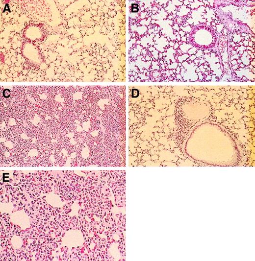 Fig. 9. Histopathological studies of lungs from wild-type, L-selectin–deficient, E/P double-selectin–null, and E/L/P triple-selectin–null mice. / Control mice (A) and L-selectin–deficient mice (B) had normal-appearing lung parenchyma. (C) In E/P double-selectin–null mice, alveolocapillary walls in tissue from inflated lungs were engorged with inflammatory cells, resulting in greatly expanded interstitial regions. (D) In contrast, the interstitial regions were remarkably more normal in the triple-null mice. Occasionally, these mice had bronchial lymphoid aggregates and a small increase in leukocytes in the alveolocapillary walls (hematoxylin and eosin, original magnification × 200). (E) Higher-power magnification (× 400) of the alveolocapillary walls from lungs of E/P double-selectin–null mice. Most of the inflammatory cells are neutrophils.