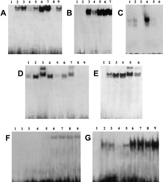 Fig. 4. GILZ inhibits NF-κB binding to its DNA motif in an EMSA assay. / (A) EMSA assay performed using nuclear extract from untreated (lanes 2-5) and anti-CD3–treated (2 hours, lanes 6-9) 3DO cells (lanes 3, 7) and empty vector– (PV6, lanes 2, 6) or GILZ-transfected (ST7, lanes 4, 8; GIRL19, lanes 5, 9) clones. Lane 1: probe alone. (B) Nuclear extract from anti-CD3–treated 3DO cells, alone (lane 3) or added with GST-GILZ fusion protein (lane 4), or buffer used for GST-GILZ preparation alone (lane 5), or GST-P56lck fusion protein (lane 6), or GST alone (lane 7) as controls. Lane 1: probe alone. Lane 2: GILZ-GST alone. (C) Nuclear extract from untreated (lanes 1, 2) or anti-CD3–stimulated (lanes 3-5), empty-vector– (PV6, lanes 1, 3, 4), or GILZ-transfected (ST7, lanes 2, 5) cells. Lane 3: control with nuclear extract from anti-CD3–treated empty vector–transfected cells plus competitor cold probe. Lane 6: labeled probe alone. (D) Nuclear extract of untreated (lanes 1, 5) or anti-CD3–treated (lanes 2-4, 6, 7) PV6 cells. Nuclear extract plus anti-p65 antibody (lane 3) or control antibody (lane 4). Nuclear extract plus GILZ-GST fusion protein (lanes 5, 6). Nuclear extract plus anti-p65 and GILZ-GST fusion protein (lane 7). Lane 8: GILZ-GST fusion protein alone. Lane 9: probe alone. (E) Nuclear extract of untreated (lane 2) or anti-CD3–treated PV6 (lanes 3-6) cells. Nuclear extract plus anti-p52 antibody (lanes 5, 6) or control antibody (lane 4). Nuclear extract plus anti-p52 and GILZ-GST fusion protein (lane 6). Lane 1: probe alone. (F,G) EMSA assay performed using as probe NF-AT and OCT-1, respectively. Nuclear extracts from untreated (lanes 2-5) or anti-CD3–treated (lanes 6-9) 3DO,37 PV6 (lanes 2, 6), ST7 (lanes 4, 8), and GIRL19 (lanes 5, 9). Lane 1: probe alone.
