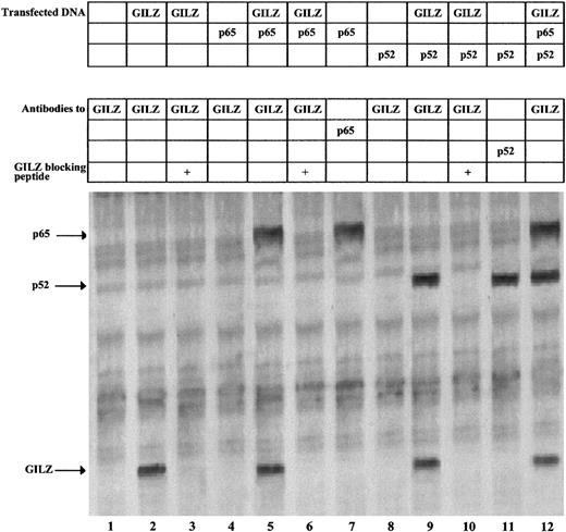 Fig. 6. GILZ coimmunoprecipitates with p65 and p52. / NTera-2 cells were transfected with 6 μg of expression plasmids for GILZ, p65, and p52 either alone or in combination. Following transfection, the cells were metabolically labeled and whole-cell extracts used for immunoprecipitations with anti-GILZ, anti-p65, and anti-p52 antibodies, as indicated. Anti-GILZ immunoprecipitations were blocked with 400 ng of the GILZ fusion protein used to generate the antibody. The arrows indicate the immunoprecipitated proteins.