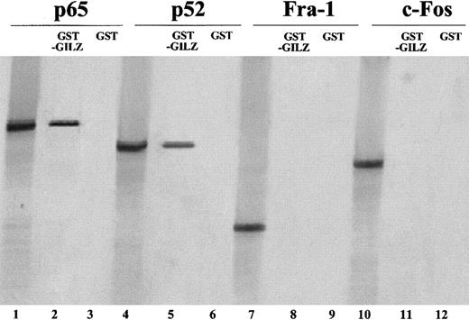 Fig. 7. GILZ physically associate in vitro with p65 and p52. / GST-GILZ fusion protein attached to glutathione Sepharose beads was incubated with 35S-labeled in vitro–transcribed p65, p52, c-fos, and Fra-1. Lanes 1, 4, 7, 10: in vitro–translated proteins (2 μL); lanes 2, 5, 8, and 11: in vitro–translated proteins (5 μL) precipitated by the GST-GILZ fusion protein attached to glutathione beads; lanes 3, 6, 9, 12: in vitro–translated proteins after precipitation with GST protein attached to glutathione beads.