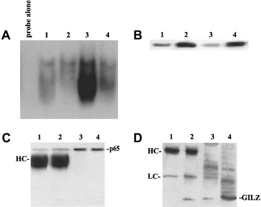 Fig. 8. Glucocorticoid treatment of thymocytes blocks NF-κB DNA binding, up-regulates GILZ expression, and induces its association with p65. / (A) EMSA analysis of NF-κB binding factors from untreated thymocytes (lane 1), or thymocytes cultured for 4 hours with 100 nM DEX (lane 2), or anti-CD3 mAb 1 μg/mL (lane 3), or the combination of anti-CD3 and DEX (lane 4). (B) Western blot analysis of GILZ. Lane 1: untreated thymocytes; lane 2: thymocytes treated with 100 nM DEX; lane 3: thymocytes treated with 1 μg/mL anti-CD3 mAb; lane 4: thymocytes treated with DEX and anti-CD3 mAb. (C,D) Immunoprecipitation of p65 and coimmunoprecipitation of GILZ. Mouse thymocytes were cultured in the presence or absence of DEX; cellular protein was collected 4 hours after stimulation and immunoprecipitated with anti-p65 antiserum (3 μL). Immunoblotting with anti-p65 antiserum (C) or anti-GILZ (D) was performed as described in the text. Lane 1: immunoprecipitation of untreated thymocytes; lane 2: immunoprecipitation of DEX-treated thymocytes; lane 3: total lysate from untreated thymocytes; lane 4: total lysates from DEX-treated thymocytes.