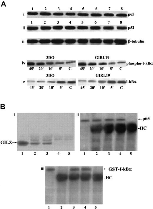 Fig. 9. GILZ does not affect p65 and P52 expression, I-κBα phosphorylation and degradation, or I-κB/NF-κB binding. / (A) Western blot analysis performed using protein lysates from untreated (lanes 1-4) or anti-CD3–treated (2 hours, lanes 5-8) 3DO cells (lanes 1, 5), empty vector–transfected clone PV6 (lanes 2, 6), GILZ-transfected clones ST7 (lanes 3, 7), and GIRL19 (lanes 4, 8). The nitrocellulose membrane was immunoblotted with anti-p65 antibody (i), or with anti-p52 antibody (ii), or with anti-β–tubuline mAb used as a control (iii). Western blot analysis of protein lysates from 3DO or GIRL19 treated with anti-CD3 mAb for the times indicated (C: untreated cells). The immunoblotting was performed using an mAb that recognizes the phosphorylated form of I-κBα (iv), or with a control antibody anti–I-κBα, phosphorylation-state independent (v). (B) Coimmunoprecipitation of p65/GILZ and p65/GST–I-κBα. In vitro–translated p65 (5 μL) was incubated overnight with GILZ (1 μg) or GILZ and GST–I-κBα (100 μg) and immunoprecipitated with anti-p65 antibody (3 μL). Immunoblotting was performed with antibody anti-GILZ (i, lane 1: nonimmunoprecipitated GILZ control; lane 2: p65 plus GILZ; lane 3: p65 plus GILZ plus GST–I-κBα; lane 4: p65 alone; lane 5: GILZ alone) or antibody anti-p65 (ii, lane 1: nonimmunoprecipitated p65 control; lane 2: p65 plus GILZ; lane 3: p65 plus GILZ plus GST–I-κBα; lane 4: p65 alone; lane 5: GILZ alone) or antibody anti–I-κBα (iii, lane 1: nonimmunoprecipitated GST–I-κBα control; lane 2: p65 plus GILZ; lane 3: p65 plus GILZ plus GST–I-κBα; lane 4: p65 plus GST–I-κBα; lane 5: GILZ plus GST-I-κBα).
