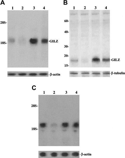Fig. 10. TCR/CD3 triggering inhibits GILZ expression. / Northern (A,C) and Western (B) blot analysis of GILZ. (A,B) Lane 1: untreated thymocytes; lane 2: thymocytes treated for 6 hours on plates coated with anti-CD3 (1 μg/mL); lane 3: thymocytes treated with 100 nM DEX for 6 hours; lane 4: thymocytes treated for 6 hours with anti-CD3 plus DEX. For the Northern blot analysis, the filter hybridized with GILZ cDNA was exposed for autoradiography for 36 hours. (C) Lane 1: untreated thymocytes; lane 2: thymocytes treated for 6 hours on plates coated with anti-CD3 (1 μg/mL); lane 3: thymocytes treated with cyclosporin A (1 μg/mL) for 6 hours; lane 4: thymocytes treated for 6 hours with anti-CD3 plus cyclosporin A. Filter hybridized with GILZ cDNA was exposed for autoradiography for 3 days.