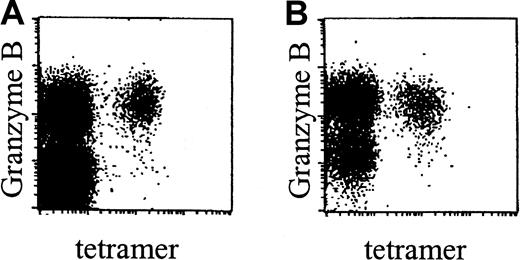 Fig. 6. CMV-specific CD8+ T cells in renal transplant recipients contain granzyme B. / Dot plots of NLVPMVATV–HLA-A2.1 tetramer-APC fluorescence (“tetramer,” x-axis, arbitrary units, log scale) versus granzyme B–PE fluorescence (y-axis, arbitrary units, log scale) within gated CD8bright T cells, in a healthy control individual (A) and an immunosuppressed renal transplant recipient (B). Subjects were matched for their CD27−CD45RA+ phenotype of CMV-specific CD8+ T cells.