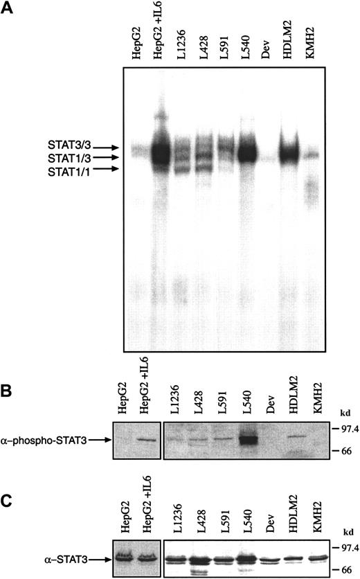 Fig. 1. Proteins from nuclear extracts from Hodgkin cell lines contain constitutively activated STAT3. / . (A) Nuclear extracts (5 μg) of each cell line were analyzed in a gel retardation experiment using the radiolabeled STAT1/3 oligonucleotide. The DNA-protein complexes were separated by electrophoresis using a native 4.5% polyacrylamide gel as described in “Material and methods” and visualized by autoradiography. For comparison, nuclear extracts from unstimulated and IL-6–stimulated HepG2 cells were included in the study. Arrows show the position of STAT3 and STAT1 homodimers and heterodimers. (B) Western blot analysis of phosphorylated STAT3. Nuclear extracts (20 μg) of each cell line were analyzed in a 10% SDS-polyacrylamide gel, transferred to a nylon membrane, incubated with an antibody specific for phosphorylated STAT3 and visualized by ECL. (C) Western blot analysis of unphosphorylated STAT3. The same nylon membrane as in panel B was reprobed with an antibody specific for STAT3 and the protein was visualized by ECL.