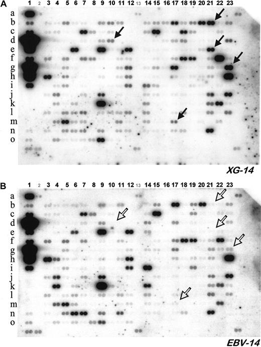 Fig. 1. Expression of 268 genes coding for cytokines, cytokine receptors, and closely related proteins in the XG-14 HMCL and the EBV-14 LCL. / Poly(A)+RNA was extracted from each cell line and used to synthesize radiolabeled cDNA. Radiolabeled cDNAs were hybridized to 2 identical gene array membranes (Atlas Human Cytokine/Receptor Array, ClonTech) and radioactivity was analyzed with a PhosphoImager. Each gene is represented by duplicate spots. Filled arrows highlight several genes that are overexpressed in the myeloma sample, whereas open arrows point out the same genes in the LCL sample.