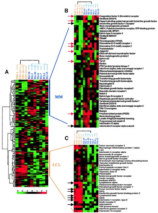 Fig. 2. Hierarchical clustering analysis. / (A) Gene expression values were log transformed (log base 2) and median centered across each sample. Analysis was performed with Cluster and TreeView software. Each row represents a separate gene and each column a separate mRNA sample. The dendrogram at the left shows the relationship of the genes according to the similarity of their expression profile across samples and the dendrogram at the top depicts the relationship of the samples according to the similarity in their gene expression profile. Each value represents the difference from the gene median and is depicted according to the color scale shown at the bottom (−3 to +3 on a log base 2 scale). Vertical bars on the right indicate clusters of coordinately expressed genes in either myeloma samples or LCLs. (B) Enlargement of the MM cluster. Black arrows point out genes overexpressed in MM samples that were previously described in MM. Red arrows point out genes overexpressed in MM samples that were not previously linked to MM. (C) Enlargement of the LCL cluster. Black arrows point out genes overexpressed in LCL samples that were previously described in LCL. See our Web site for full data (http://www.u475.montp.inserm.fr/).