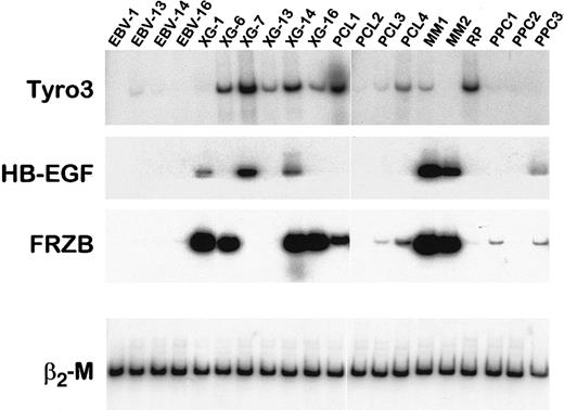 Fig. 4. RT-PCR analysis of Tyro3, HB-EGF, and FRZB mRNA in primary plasma cells. / RT-PCR analysis of Tyro3, HB-EGF, and FRZB was performed on cDNA from LCLs, HMCLs, purified primary malignant cells from patients with plasma cell leukemia (PCL1-4) or myeloma (MM1-2), and purified PPCs obtained from one patient with RP or by in vitro differentiation of peripheral blood B cells into plasma cells (PPC 1-3). Amplification of β2-M shows the equivalence of the cDNA loading and amplification. Data are representative of at least 2 independent RT-PCRs.