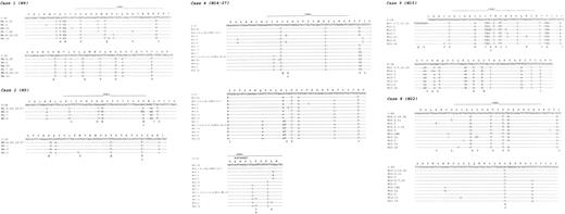 Fig. 1. Nucleotide and deduced amino acid sequences of VH genes derived from nodal MZLs. / Comparisons were made with the most homologous germ line VHgenes. Dashes represent identity with the representative germ line sequence. Nucleotide differences are shown in lowercase letters whenever a replacement mutation is concerned. Silent mutations are shown in capital letters. Replacement amino acids are also indicated at the bottom of each scheme. One insertion (case no. 5) is shown in FW2 as extra nucleotides.