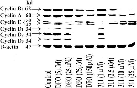 Fig. 2. The iron chelator 311 is more effective than DFO at decreasing the expression of the cyclins A, B1, D1, D2, and D3 and increasing the expression of cyclin E. / SK-N-MC cells were incubated with DFO (5-150 μM) or 311 (1-25 μM) for 30 hours at 37°C, and the cells were harvested. Western blot analysis was then performed as described in “Materials and methods.” Results shown are representative of 3 separate experiments performed.