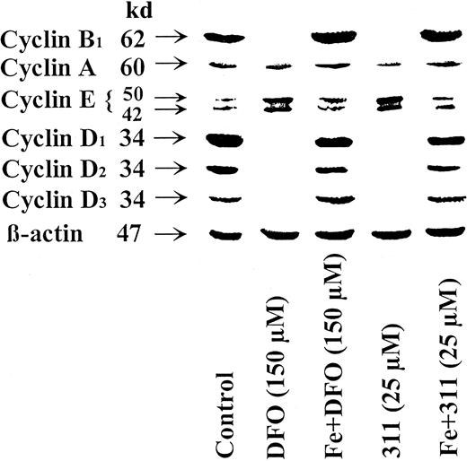 Fig. 3. Saturation of DFO or 311 with iron prevents their effects at reducing the protein levels of cyclin A, B1, D1, D2, and D3 and increasing cyclin E protein levels. / The SK-N-MC neuroepithelioma cell line was incubated with DFO (150 μM), the DFO-Fe complex (150 μM), 311 (25 μM), or the 311-Fe complex (25 μM) for 30 hours at 37°C. Western blot analysis was then performed as described in “Materials and methods.” Results shown are representative of 3 separate experiments performed.