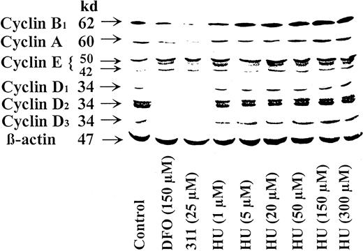 Fig. 4. Ribonucleotide reductase inhibitor HU acts differently to DFO and 311 as it increases the protein levels of cyclins A, B1, D1, D2, and D3 but has similar action to chelators in terms of increasing cyclin E. / The SK-N-MC neuroepithelioma cell line was incubated for 30 hours at 37°C with DFO (150 μM), 311 (25 μM), or HU (1-300 μM). Western blot analysis was then performed as described in “Materials and methods.” Results shown are representative of 3 separate experiments performed.