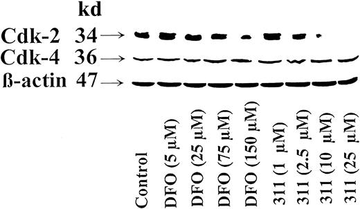 Fig. 5. Chelator 311 markedly reduced the expression of cyclin-dependent kinase 2 (cdk-2) but not cdk4. / The SK-N-MC neuroepithelioma cell line was incubated for 30 hours at 37°C with DFO (5-150 μM) or 311 (1-25 μM). Western blot analysis was then performed as described in “Materials and methods.” Results shown are representative of 3 separate experiments performed.