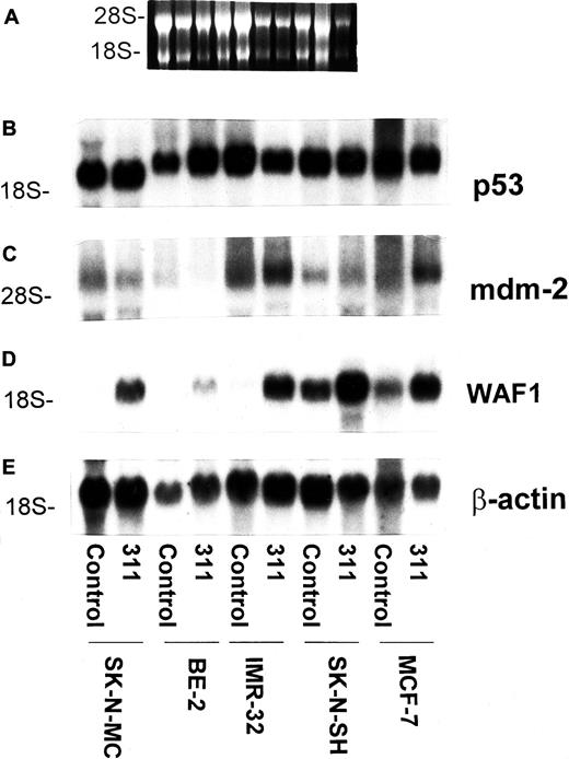 Fig. 6. The chelator 311 has no effect on p53 or mdm-2 mRNA levels but increases the expression of WAF1 mRNA in a variety of cell types with wild-type or mutant p53. / The SK-N-MC neuroepithelioma, BE-2 neuroblastoma, IMR-32 neuroblastoma, SK-N-SH neuroblastoma, and MCF-7 breast cancer cell lines were exposed to control medium or 311 (25 μM) for 30 hours at 37°C. Cells were harvested, and the total mRNA was isolated using standard techniques.20 (A) Ethidium bromide staining of the agarose gel; (B) p53; (C) mdm-2; (D) WAF-1; (E) β-actin. The result is representative of 2 separate experiments performed.