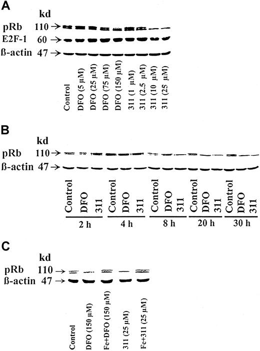 Fig. 8. Effect of chelator concentration, chelator incubation time, and complexation with Fe on the phosphorylation status of the retinoblastoma susceptibility gene product (pRb). / (A) Chelator concentration. The SK-N-MC neuroepithelioma cell line was incubated for 30 h at 37°C with DFO (5-150 μM) or 311 (1-25 μM). (B) Chelator incubation time. Cells were incubated for 2-30 h with DFO (150 μM) or 311 (25 μM). (C) Complexation with Fe. Cells were incubated with DFO (150 μM) or 311 (25 μM) or their preformed Fe complexes for 30 hours at 37°C. Western blot analysis was then performed after each of these incubation conditions, as described in “Materials and methods.” Results shown are representative of 3 separate experiments performed.