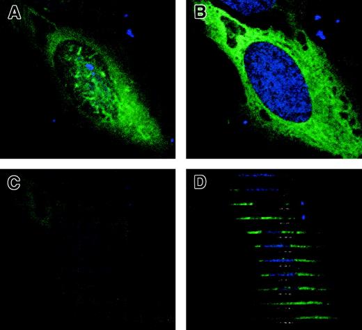 Fig. 1. Cytoplasmic localization of full-length pyrin in HeLa cells by confocal microscopy. / HeLa cells transfected with myc-tagged pyrin plasmid were labeled with anti-myc antibody followed by anti–mouse IgG Alex Fluor 488 (green), plus TO-PRO-3 nuclear dye (blue). (A) Proximal XY-plane (0 μM) of immunofluorescence of myc-tagged pyrin. (B) Median XY-plane (−1.05 μm). (C) Distal XY-plane (−2.1 μm). (D) Computer-generated XZ-sections of the same cell. Sections progress from top to bottom of XY-plane images. Magnification × 1000.