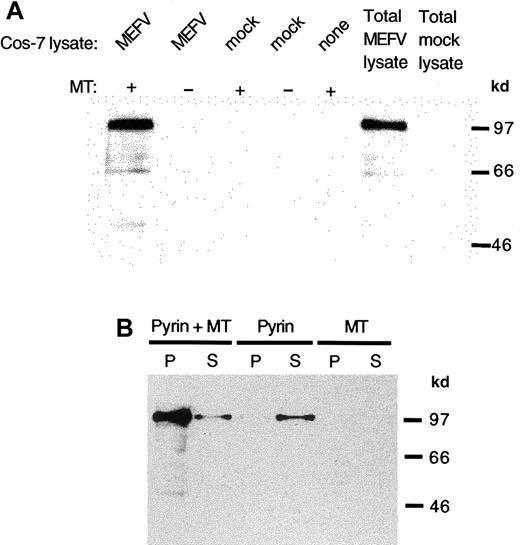 Fig. 5. Binding of pyrin to stabilized microtubules in vitro. / Lysates were prepared from MEFV cDNA or mock-transfected cells and added to bovine brain microtubules stabilized with paclitaxel. Pyrin was detected with antipyrin antibody and horseradish peroxidase–linked anti–rabbit IgG. (A) Pyrin in lysates of Cos-7 cells transfected with MEFV cDNA was sedimented in the presence of microtubules (lane 1) but not when microtubules were absent (lanes 2). Mock-transfected cell lysates did not show any pyrin sedimentation with or without microtubules (lanes 3 and 4). Neither microtubules nor mock-transfected cell lysate contain pyrin (lane 5 and 7). Lysate from cells transfected with MEFV cDNA contained pyrin (lane 6). (B) Purified recombinant pyrin cosedimented with paclitaxel-stabilized microtubules (lane 1) with some pyrin remaining in the supernatant (lane 2). In the absence of microtubules, purified pyrin did not sediment (lane 3) but remained in the supernatant (lane 4). The microtubule preparation did not contain pyrin in the pellet (lane 5) or in the supernatant (lane 6).