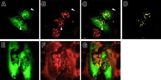 Fig. 7. Colocalization of pyrin with actin by confocal microscopy. / HeLa cells were transfected with pEGFP-MEFV.N plasmid. After fixing, cells were stained with phalloidin–Alexa Fluor 568. (A) GFP fluorescence showing staining of ruffles over the nucleus and lamellar structures (arrows). (B) Phalloidin staining of actin fibers. Shorter fibers are ruffles over the nucleus, and in lamellar structures (arrows). (C) Merged green and red channels with yellow signal at overlap. Arrows highlight overlap at nuclear and lamellar ruffles. (D) Colocalization mask computed using linear gating (see “Materials and methods”). (E-G) HeLa cells transfected with pEGFP-MEFV.N plasmid were treated with 10 μM cytochalasin D for 2 minutes, then fixed and stained with phalloidin–Alexa Fluor 568. GFP-pyrin (E) remains colocalized with the disintegrating actin scaffolding (F). Merged fluorescence images (G) demonstrate punctate colocalization overlying and surrounding the nuclear region. Magnification × 1000.