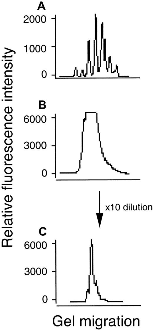 Fig. 3. CDR3 size distribution analysis of BV14 or BV16 cDNA from PBLs in patient 22. / The cDNA amplified using primers specific to BV16 subfamilies coupled with a fluorescent Cβ primer was analyzed for size with an automated DNA sequencer and Genescan software. Fluorescence intensity (y axis) is plotted against CDR3 size (x axis). (A) BV14 indicating normal pattern. (B) BV16 indicating abnormal pattern with high-fluorescence intensity. (C) Abnormal pattern after 10 times dilution of panel B indicating monoclonal proliferation of T cells.