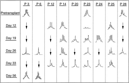 Fig. 5. Changes in the CDR3 size distribution pattern of BV16 cDNA at different time points. / GVHD developed in 6 patients (patients 3, 6, 14, 20, 25, 28). Three patients (patients 12, 23, 24) did not have clinical signs of autologous GVHD.
