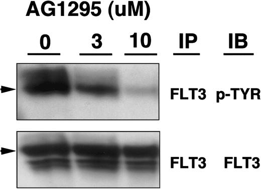 Fig. 3. Inhibition of FLT3 phosphorylation by AG1295. / Blasts from an AML sample with constitutively activated FLT3 were incubated at 37°C and 5% CO2 for 4 hours with increasing concentrations of AG1295. Clarified lysates (500 μg) were immunoprecipitated (IP) with anti-FLT3 antibody, resolved by sodium dodecyl sulfate-polyacrylamide gel electrophoresis (SDS-PAGE), transferred to membranes, immunoblotted (IB) with antiphosphotyrosine (p-tyr) or anti-FLT3 antibodies, and visualized with chemiluminescence. Arrowheads identify FLT3.
