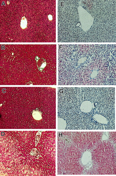 Fig. 1. Histologic examination reveals zonal hepatic microvesicular steatosis inFancc−/−Sod1−/− mice. / Histology of Fancc−/−Sod1−/− and control livers (magnification × 400). Sections ofFancc−/−(A,E),Sod1−/−(B,F),Fancc+/−Sod1+/− (C,G),and Fancc−/−Sod1−/− (D,H) livers were stained with Masson trichrome (A-D) and oil red-O (E-H). WhereasFancc−/−, Sod1−/−, andFancc+/−Sod1+/−cells show normal morphology, Fancc−/−Sod1−/−hepatocytes demonstrate a zone 3 abnormality characterized by abundant cytoplasmic vacuolation. Staining with oil red-O demonstrates prominent microvesicular zone 3 lipid accumulation without nuclear displacement in Fancc−/−Sod1−/−mice. Small amounts of lipid droplets are present inSod1−/− mice.