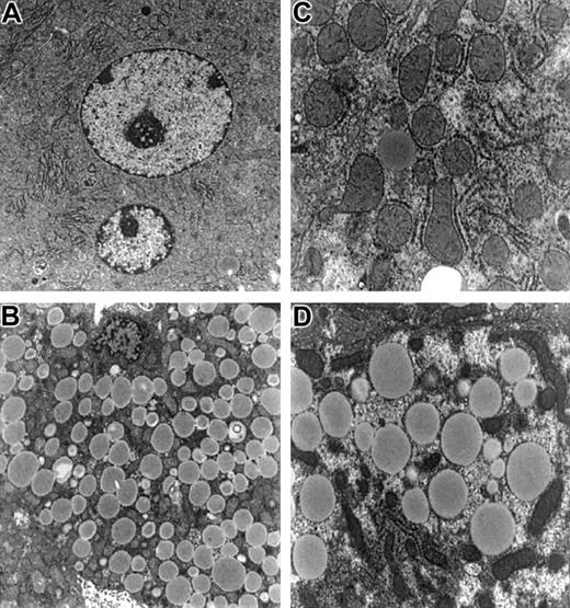 Fig. 2. Electron microscopy of hepatocytes from. / Fancc−/−Sod1−/− mice reveals no increase in organelle damage. Hepatocytes fromFancc+/−Sod1+/− (A,C) andFancc−/−Sod1−/−(B,D) mice stained with osmium tetroxide. (A) A normal multinucleated centrilobular hepatocyte (× 5400) and (C) a higher magnification showing normal organelles (× 11 750). (B) Microvesicular steatosis in a centrilobular Fancc−/−Sod1−/−hepatocyte (× 5400) and (D) (× 11 750).