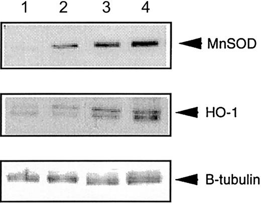 Fig. 4. Liver-specific expression of MnSOD and HO-1 is increased in. / Fancc−/−Sod1−/− mice.Autoradiographs showing total liver lysates immunoblotted with antibodies against MnSOD and HO-1, and normalized for loading with anti–β-tubulin antibody. Lane 1 control (Stressgen Biotech, Victoria, British Columbia, Canada), lane 2Fancc+/+Sod1+/+, lane 3Fancc+/−Sod1+/−, and lane 4Fancc−/−Sod1−/− liver lysates.