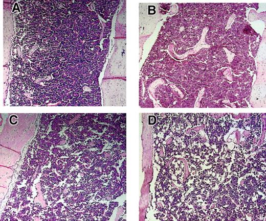 Fig. 5. Hypocellularity and increased fat accumulation in Fancc−/−Sod1−/−BM. / Metaphyseal sections of leg bones fromFancc+/+Sod1+/+ (A),Fancc−/− (B), Sod1−/− (C), and Fancc−/−Sod1−/− (D) mice (magnification × 400). Marrow fat content (clear areas) is increased in Fancc−/−Sod1−/− mice compared with Fancc+/+ Sod1+/+ or toFancc−/−. Controls revealed only rare fat cells,whereas Sod1−/− mice did show some increase in fat spaces.
