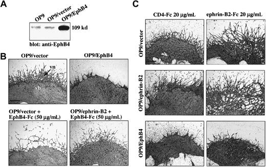 Fig. 2. OP9/EphB4 stromal cells inhibited vascular network formation from E9.5 P-Sp explants. / (A) OP9 cells were cotransfected with expression plasmid DNA pRK5-EphB4 (OP9/EphB4) and pCAGneo or expression vector pCAGneo alone (OP9/vector), and individual G418-resistant clones were selected (OP9/EphB4 or OP9/vector). Protein expression was observed by immunoblotting using anti-EphB4 PolyAb as portrayed in Figure 1A. (B) P-Sp explants were cocultured with OP9/EphB4 or OP9/vector stromal cells. After 14 days, the cultures were immunostained by anti–PECAM-1 MoAb. The formation of vascular networks (vn) was inhibited on the OP9/EphB4 stromal cells compared with the OP9/vector stromal cells. Vascular network formation was also inhibited by the addition of EphB4-Fc in both the OP9/vector and OP9/ephrin-B2 stromal cells. The bar indicates 500 μm. (C) P-Sp explants were cocultured with OP9/ephrin-B2, OP9/EphB4, or OP9/vector stromal cells in the presence of chimeric protein ephrin-B2–Fc for 10 days. The vascular EC sprouting and remodeling from P-Sp explants was promoted by the addition of ephrin-B2–Fc, especially in OP9/ephrin-B2 stromal cells. The bar indicates 500 μm.