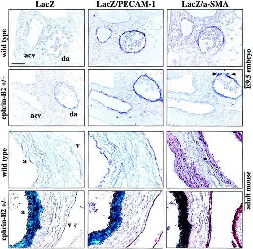 Fig. 5. LacZ/ephrin-B2 expression in mouse embryo and adult mouse vascular tissue. / E9.5 embryos from ephrin-B2 heterozygous and wild-type embryos, abdominal/thoracic aorta, and superior/inferior vena cava with surrounding tissues from adult ephrin-B2 heterozygous or wild-type mice were stained with LacZ staining solution. After LacZ staining, the samples were postfixed, embedded, and sectioned. Then the vascular ECs and surrounding cells/SMCs were examined by immunochemical staining with anti–PECAM-1 and anti–α-SMA antibodies. No LacZ staining was observed in wild-type embryos or in adult tissue. In ephrin-B2 heterozygous embryos, LacZ/ephrin-B2 (blue) was obviously detected in the dorsal aorta (da) ECs and surrounding cells with PECAM-1 (red) and α-SMA (red) (arrowheads) but not in the anterior cardinal vein (acv). In adult tissue the LacZ/ephrin-B2 was coexpressed with PECAM-1 and α-SMA in the arterial ECs and SMCs but not in the venous ECs and SMCs. PECAM-1– and α-SMA–stained cells were identical in expression to the arterial ECs and SMCs in wild-type mice; a indicates aorta; v, vena cava. The bar indicates 25 μm.