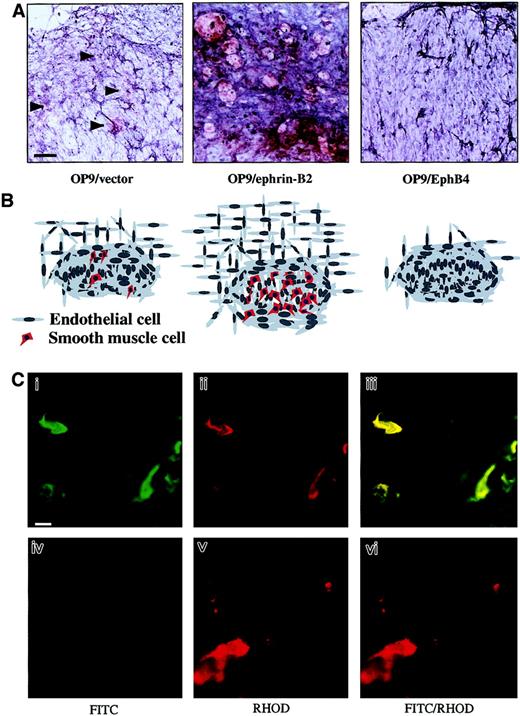 Fig. 7. OP9/ephrin-B2 supported SMC recruitment, whereas OP9/EphB4 and EphB4-Fc inhibited it. / (A) The vascular networks in the P-Sp explant cultures were visualized by PECAM-1 staining (blue), and the anti–α-SMA antibody was used to detect the SMCs on the P-Sp culture system after coculture for 14 days. The α-SMA+ (red) cells were located more abundantly in the vascular bed on OP9/ephrin-B2 stromal cells than in OP9/vector stromal cells (arrowheads indicate the α-SMA+ cells), and almost no α-SMA+ (red) cells were detected in the OP9/EphB4 stromal cells. The bar indicates 100 μm. (B) Schematic presentation of SMC recruitment under various conditions. Figures correspond to the upper panels in panel A. (C) SMA+ cells were derived from P-Sp explants. P-Sp explants from embryos of green mice expressing GFP ubiquitously (i-iii) and wild-type embryos (iv-vi) were cocultured with OP9 stromal cells, and the culture plates were immunostained with Cy3-conjugated anti–α-SMA antibodies. Green indicates cells from GFP P-Sp explants; red indicates α-SMA+ cells; and yellow indicates GFP and α-SMA++ cells. Panels Ci and Civ are fluorescein isothiocyanate (FITC) specific, Cii and Cv are rhodamine (RHOD)–specific wavelengths, and the merged configuration is shown in panels Ciii and Cvi. The bar indicates 25 μm.