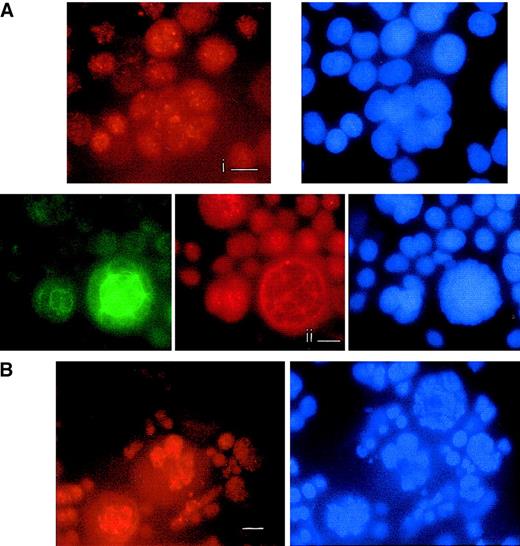 Fig. 7. Studies of hCdh1 and cyclin B1 expression in megakaryocytes. / Immunofluorescence was performed on day 6 megakaryocyte culture as described in Figure 5. (A) HCdh1 immunodetection in human megakaryocytes. (i) Interphase polyploid megakaryocyte shows a nuclear hCdh1 staining, using a polyclonal rabbit antibody followed by donkey TRITC-labeled F(ab′)2 fragments. DNA was counterstained with DAPI. (ii) Double immunostaining of hCdh1 and tubulin with DNA painting. HCdh1 was localized at the spindle poles during endomitosis. Bar, 10μm. (B) Timing of cyclin B1 degradation in endomitosis. Cyclin B1 was immunodetected by using a mouse antibody followed by incubation with TRITC-conjugated antimouse F(ab′)2 fragments. DNA was labeled with DAPI. Three sequential phases of endomitosis were observed on a single view: G2/M megakaryocyte in the middle with a strong nuclear staining, prometaphase megakaryocyte in the lower-left corner with cyclin B1 localized at the spindle poles, and anaphase in the upper-right corner in which cyclin B1 is undectectable. Bar, 10 μm.