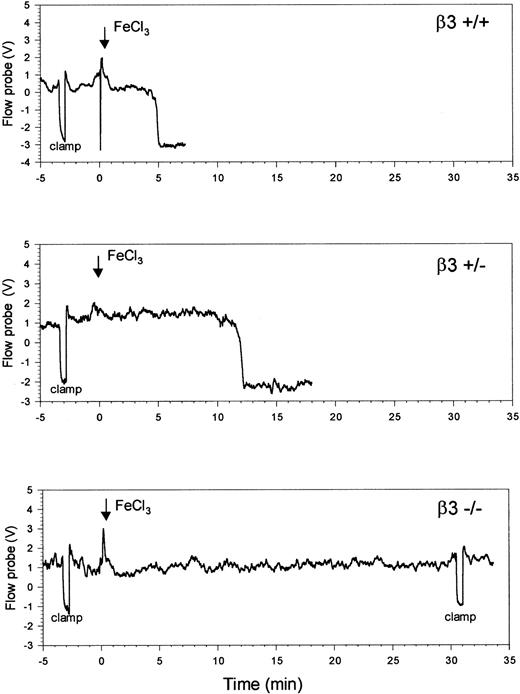Fig. 3. β3-null (β3−/−) mice are protected from FeCl3-induced thrombosis of the carotid artery. / To determine the extent of temperature change during the cessation of blood flow, the arteries were occluded for 30 seconds with a vascular clamp before the application of FeCl3 (arrow). Time to maximal temperature reduction occurred 5 minutes and 12 minutes after the initiation of injury in the β3+/+ mouse and the β3+/− mouse, respectively. Up to 30 minutes after the addition of FeCl3, no temperature reduction occurred in the β3−/− mouse, at which time the clamp was re-applied to document that the vessel was still patent.