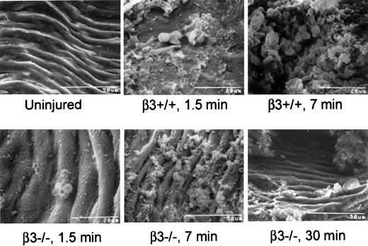 Fig. 5. Scanning electron micrographs of carotid arteries of β3+/+ and β3−/− mice exposed to FeCl3 for differing time intervals demonstrate an occlusive platelet- and erythrocyte-rich thrombus in the β3+/+ mice and a platelet monolayer with small erythrocyte accumulations in the β3−/− mice.