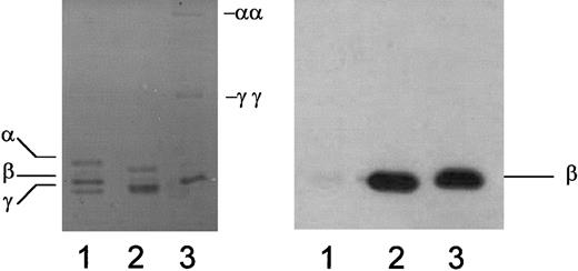 Fig. 8. mAb 350 recognizes the β-chain of mouse fibrin but does not react with fibrinogen. / Mouse fibrinogen (lane 1), mouse fibrin prepared in the absence of calcium to limit endogenous factor XIII–mediated cross-linking (lane 2), or mouse fibrin prepared in the presence of calcium to promote endogenous factor XIII–mediated cross-linking (lane 3) was separated by polyacrylamide gel electrophoresis and visualized with Coomassie staining (left) or subjected to immunoblot analysis with mAb 350 (right). γγ, γ-dimer; αα, α polymer.