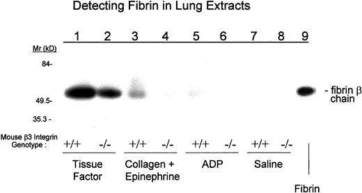 Fig. 9. After the injection of prothrombotic agents, more fibrin deposits in the lungs of β3+/+ mice than in those of β3−/− mice. / Lung extracts from mice injected with the indicated agents were separated by polyacrylamide gel electrophoresis and subjected to immunoblot analysis with mAb 350 to detect fibrin.