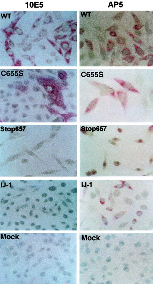Fig. 5. Detection of GPIIIa and GPIIb/IIIa complexes within transfected cells using immunohistochemical staining. / Transfected cells were stained with monoclonal antibodies AP5 and 10E5 against GPIIIa and GPIIb/IIIa complex, respectively. Antibody binding was determined by alkaline phosphatase–antialkaline phosphatase staining. It can be seen that GPIIIa was detected in cells containing IJ-1, Stop657, C655S, and WT, whereas GPIIb/IIIa was detected in WT and C655S but not in IJ-1 and Stop657. Original magnification, × 200-400..