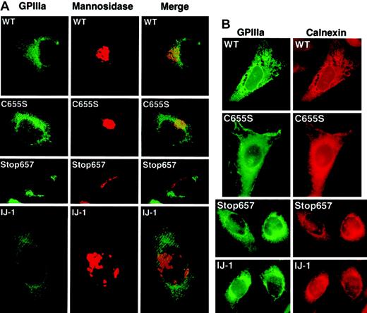 Fig. 7. Cellular localization of GPIIIa by immunofluorescence staining. / Transfected cells were stained simultaneously with AP5, a monoclonal antibody against GPIIIa, and rabbit polyclonal antibodies against mannosidase II (a Golgi marker) or calnexin (an ER marker). (A) Staining with AP5 (green) and anti–mannosidase II (red) shows diffuse GPIIIa in all transfected cells, with no visible aggregation of GPIIIa in the Golgi. The merge, however, does detect small amounts of GPIIIa (yellow color) only in WT and C655S. Original magnification, × 1000. (B) Staining with AP5 (green) and anti-calnexin (red) shows a similar distribution of GPIIIa and ER marker in all types of transformed cells. The substantial AP5 staining in WT and C655S cells probably represents GPIIIa on the cell surface. Original magnification, × 1000.