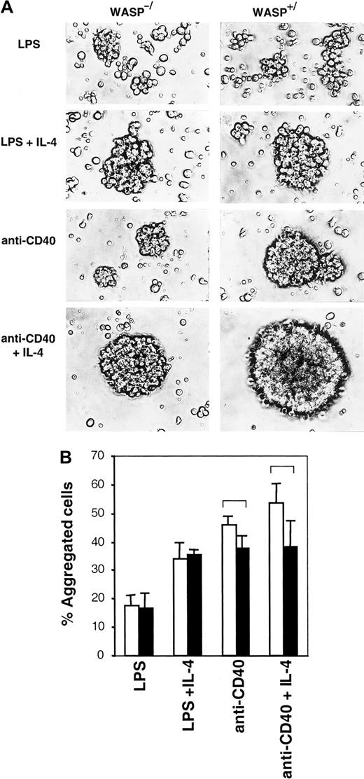 Fig. 5. Aggregation is mildly impaired in the absence of WASP. / B cells from WASP− (▪) and WASP+ (■) mice were cultured for 46 to 50 hours with indicated stimuli. (A) Cells were photographed using a camera connected to an inverted microscope with a × 20 objective. Similar results were obtained in at least 5 experiments. (B) Aggregate cultures were gently resuspended, and single versus aggregated cells were enumerated. Mean values of triplicate experiments are shown. Error bars represent 1 SD, and at least 500 cells were counted in each group. Brackets indicateP < .07 using a 2-tailed t test. This observation is representative of 3 similar experiments.