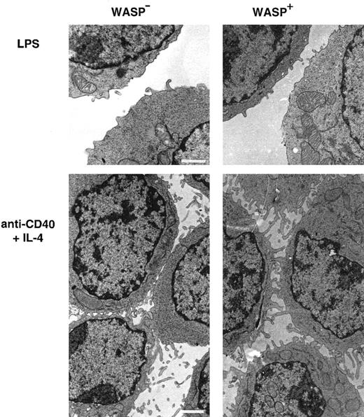 Fig. 6. Activated WASP− B lymphocytes express short microvilli. / B cells from WASP− and WASP+ mice were cultured for 48 hours with indicated stimuli, gently resuspended, then fixed and prepared for transmission electron microscopy. Note the extensive network of microvilli in cell contacts of anti-CD40 plus IL-4–stimulated cells, especially pronounced in WASP+cells. These observations are representative of 2 similar experiments. Size bar represents 1 μm. Original magnification 3800 × (LPS) and 3000 × (anti-CD40 plus IL-4).