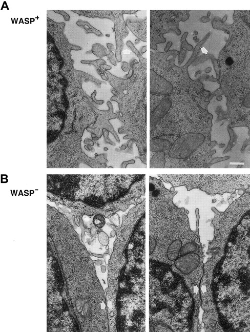 Fig. 7. Microvilli on WASP− B lymphocytes are shorter and less pronounced in cell contacts. / Higher magnification of cell contacts from the electron microscopy studies in Figure 6. IL-4– and anti-CD40–stimulated WASP− and WASP+ B cells are shown. (A) Note extensive microvilli contacts (white arrows) between WASP+B cells and the irregular cell shapes. (B) Microvilli network between WASP− B cells was less extensive or absent, and cells had smooth surfaces (white arrows). Size bar represents 0.4 μm. Original magnification 8000 ×.