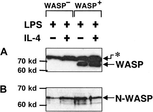 Fig. 8. N-WASP is expressed in activated murine B lymphocytes. / Detergent lysates of B cells, stimulated with LPS or LPS plus IL-4 for 46 to 50 hours, were separated using SDS-PAGE, blotted, and exposed to antibodies against WASP or N-WASP. (A) Anti-WASP antibodies recognized WASP in WASP+ B cells and in an unknown, higher molecular species (asterisk) in both WASP+ and WASP− B cells. (B) Anti–N-WASP antibody recognized a band consisting of 2, perhaps 3, species that most likely represent different phosphorylation states of N-WASP. These data are representative of 3 similar experiments.