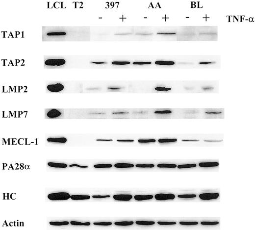 Fig. 1. Expression of the molecules involved in MHC class I–restricted antigen presentation is modulated by TNF-α. / Total lysates of 105 cells untreated or treated with TNF-α were subjected to Western blot analysis and visualized by enhanced chemiluminescence. Specific antibodies used were directed to TAP1, TAP2, LMP2, LMP7, MECL-1, PA28α, and MHC class I heavy chain (HC). LCL, which has a phenotype of activated B cells, was used as a positive control, and T2, which has a homozygous deletion in the MHC region including both LMPs and TAPs as a negative control for catalytic subunits of the immunoproteasome and TAP1/TAP2 expression. To confirm equal protein loading in the samples, actin-specific antibodies were used for each Western blot procedure. Three to 4 independent experiments were performed for each cell line. Results of one representative experiment are shown.