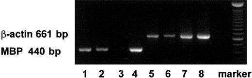Fig. 1. Expression of transcripts for MBP in MCs and eosinophils with RT-PCR. / The transcripts for MBP (440 bp) and those for β-actin (661 bp) are shown in lanes 1 to 4 and lanes 5 to 8, respectively. The transcripts were obtained from PB-derived MCs (lanes 1, 5), CB-derived MCs (lanes 2, 6), PB-derived primary eosinophils (lanes 3, 7), and CB-derived immature cultured eosinophils (lanes 4, 8).2627Similar results were obtained with 2 other experiments.