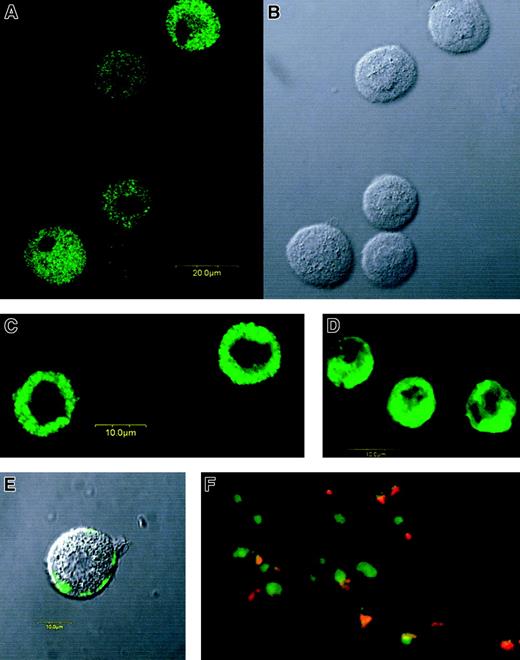 Fig. 3. Immunofluorescent staining of MBP in MCs and eosinophils. / Confocal fluorescence image with anti-MBP MoAb (A) and differential interference contrast image (B) of permeabilized CB-derived cultured MCs (1-μm section). Confocal fluorescence images with anti-MBP MoAb of permeabilized lung-derived purified MCs (C) and permeabilized PB-derived purified eosinophils (D). MBP was also detected even in unpermeabilized CB-derived cultured MCs, but only after anti-IgE challenge. (E) Confocal fluorescence and differential interference contrast images were synthesized in the figure. (F) Double staining for MBP (FITC) and tryptase (rhodamine) of a skin biopsy sample obtained from a patient with severe atopic dermatitis. Green images represent MBP-only positive cells, whereas orange-yellow images show MBP and tryptase double-positive cells. Tryptase-only positive cells (red images) were not found in this study, including samples from 2 patients with atopic dermatitis and 2 normal control subjects. Use of a control antibody confirmed all of the positive staining findings to be specific for anti-MBP and antitryptase antibodies.
