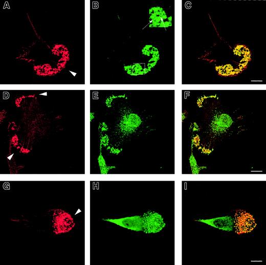Fig. 1. Formation of podosomes by normal immature DCs. / Normal immature DCs plated for 2 hours on fibronectin form podosomes. DCs were stained with TRITC-phalloidin (panels A, D, G) or antivinculin (panel B), antiphosphotyrosine (panel E), or anti–Arp2/3 (panel H) antibodies. Merged images are shown in panels C, F, and I. Under these conditions, the majority of normal DCs adopt a polarized morphology. An abundant f-actin pool is concentrated in punctate condensations at the cell-substratum interface situated just behind the leading edge (arrowheads in panels A, D, G). Rings of vinculin around the actin core confirm that these are podosomes (panel B and insert arrows in panel B). Both tyrosine-phosphorylated proteins (panel E) and the Arp2/3 complex (panel H) colocalize with f-actin in podosomes (panels F, I). Scale bars represent 10 μm.