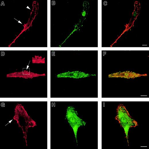 Fig. 2. Cytoskeleton of WASp-null immature DCs. / WASp-null immature DCs plated for 2 hours on fibronectin lack podosomes and form abnormal lamellipodia. DCs were stained with TRITC-phalloidin (panels A, D, G) or antivinculin (panel B), antiphosphotyrosine (panel E), or anti–Arp2/3 (panel H) antibodies. Merged images are shown in panels C, F, and I. WASp-null DCs are characterized by diffuse f-actin distribution (panels A, D, G,) with predominantly cortical actin staining (arrowhead in panel A). Podosomes are universally absent. Many cells exhibit a hyper-elongated morphology and form abnormal lamellipodia randomly over the cell surface (arrows in panels A, D, G and insert in panel D). Similarly, a diffuse pattern of staining was seen for vinculin (panel B), phosphotyrosine (panel E), and the Arp2/3 complex (panel H). Scale bars represent 10 μm.