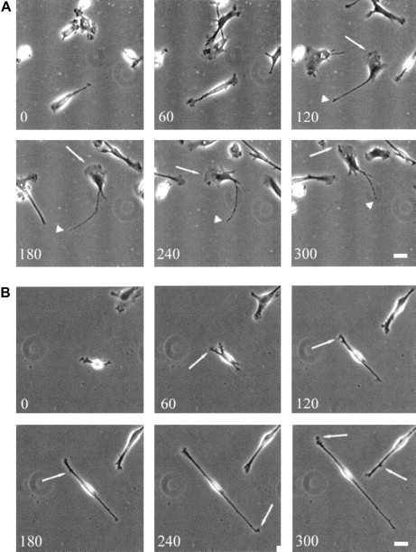 Fig. 3. Translocation of normal and WAS-immature DCs. / Translocation of WAS immature DCs on a fibronectin substratum is severely compromised. Scale bars represent 10 μm. Frames were taken at 60-minute intervals for up to 300 minutes. (A) Over time, normal immature DCs become polarized and begin random translocation over the substratum. In general, migrating cells have a well-developed broad and stable leading edge (arrows) with a fine uropod (arrowheads) that retracts into the cell body at sporadic intervals, resulting in net cell translocation. (B) In contrast, many WAS DCs elongate to an extreme degree. Persistent broad, leading-edge lamellipodia do not form, although small, transient extensions are formed randomly around the cell periphery (arrows). Cells fail to select a leading edge or a uropod, and net cell translocation over the substratum is severely compromised.